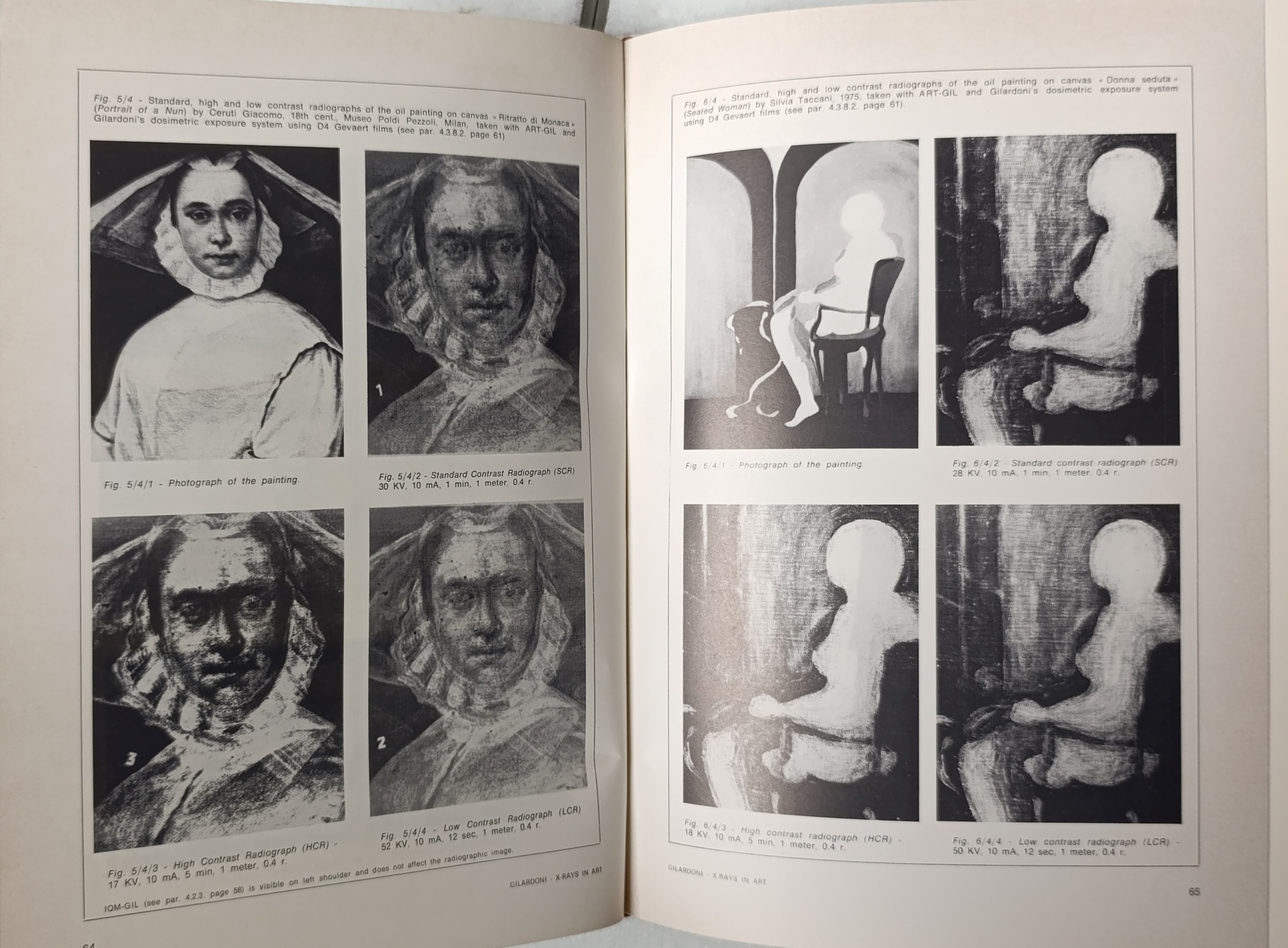 X-rays in art, Arturo Gilardoni