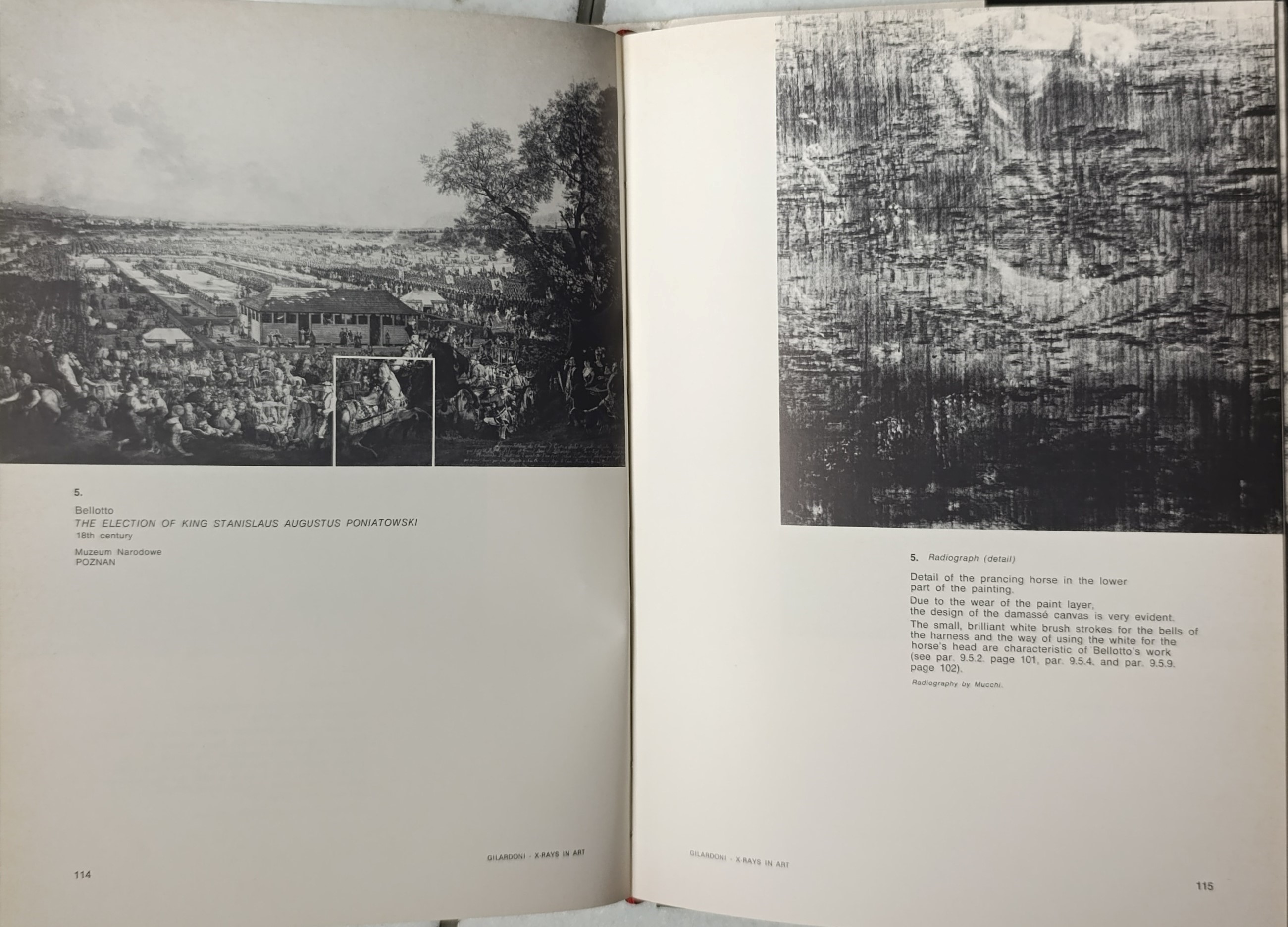 X-rays in art, Arturo Gilardoni